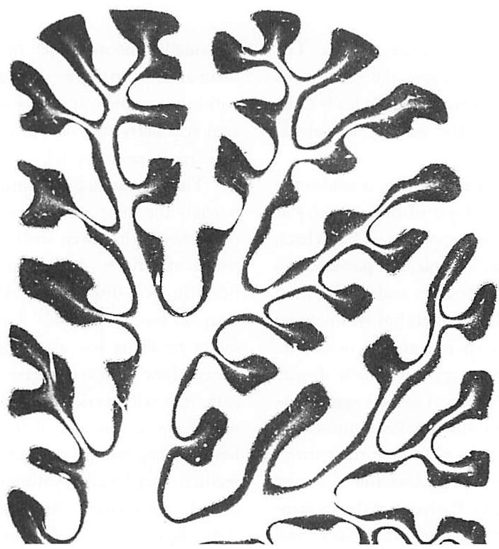 Cross-section of a cerebellum